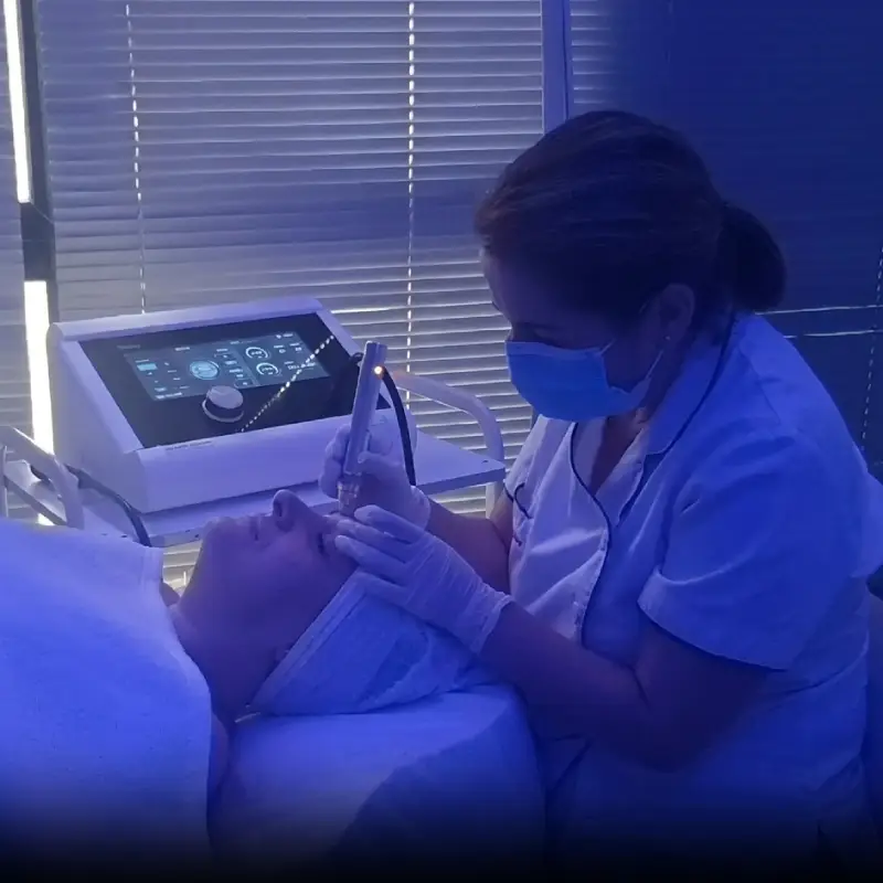 Profesiona en una sesión de dermapen